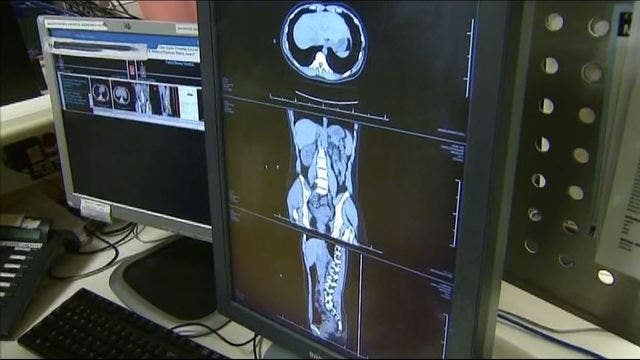 Cancer cure? Scientists claim to expect cure in one year