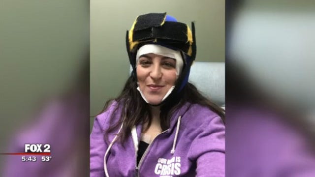 Michigan mom finds hope to prevent hair loss during breast cancer fight