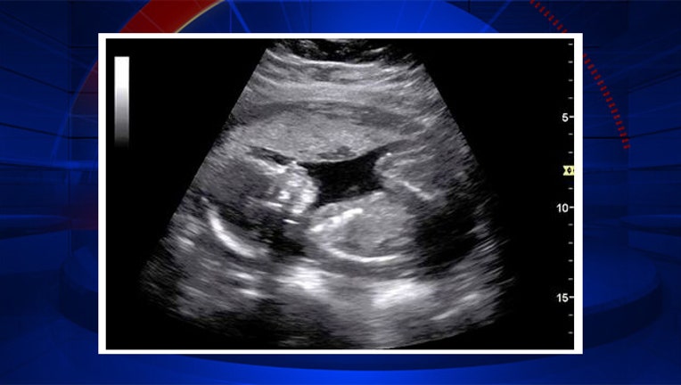 ultrasound-fb-pic-bkgd.jpg