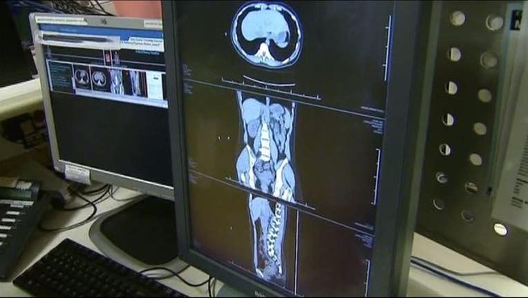 wjbk-cancer study-012919_1548773119762.JPG.jpg