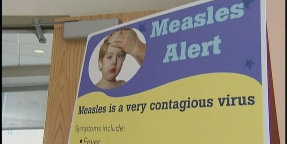 Measles in Michigan: What to know about the virus