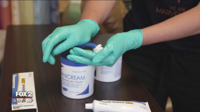 Eczema, food allergies and asthma all on the rise in kids - Doctors say it's not a coincidence