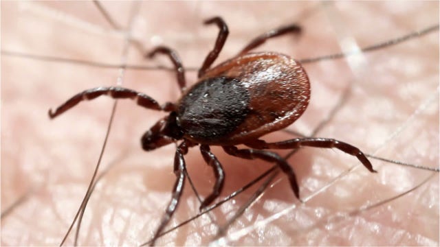 ‘This looked like a speck of wood:' Man discovers tick embedded in his eye