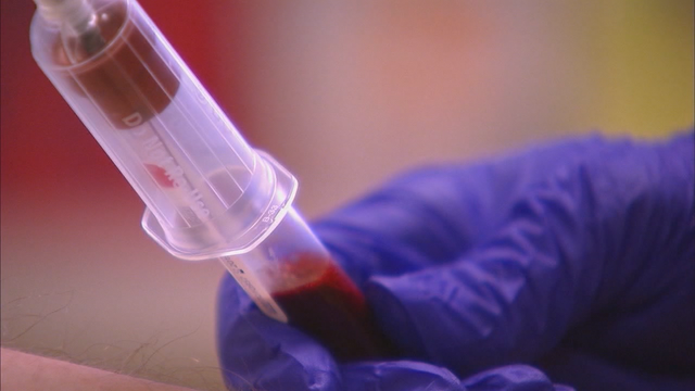 Blood test can predict if you'll die in next 10 years, researchers claim
