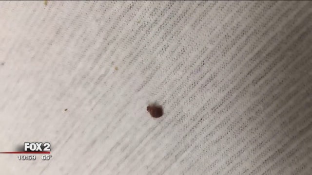 Man finds bed bug on mattress, bites on his body at Detroit Receiving