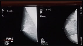 The Doctor Is In: Mammograms