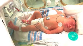 New Jersey baby born with ‘brain outside of skull’ believed to be first to survive condition