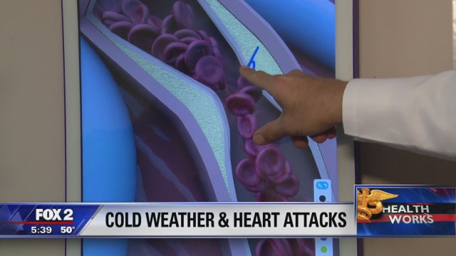 Cold weather linked to heart attacks