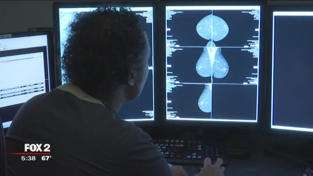 All the things you didn't know, but definitely should know, about mammograms