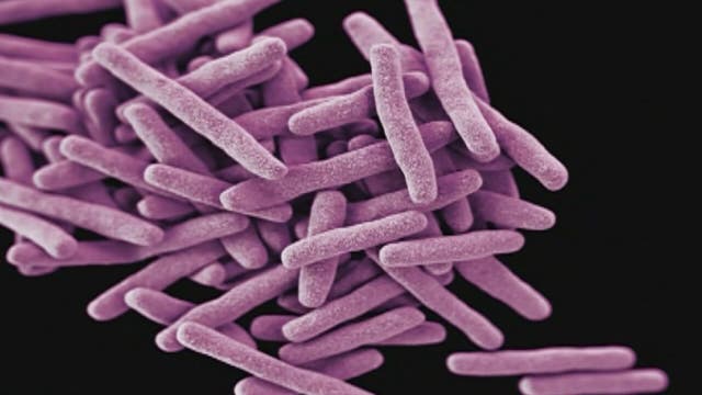5 workers at Michigan wildlife lab get latent form of tuberculosis