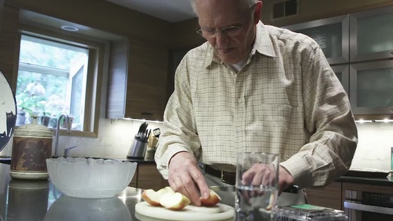 Study finds bacteria in mouth, oral hygiene linked to psoriasis