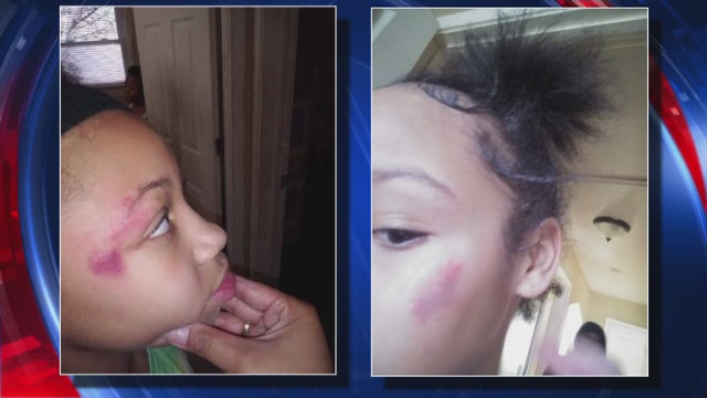 Parent allegedly jumps into Detroit school fight, assaulting student