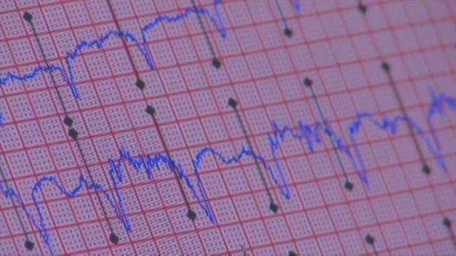 ERs seeing less heart attack, stroke patients during COVID-19