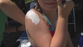 Doctors remind DIY sunscreens are often ineffective as summer approaches