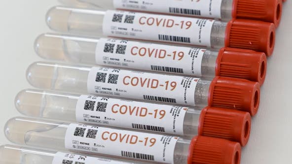 Do I need to get tested for COVID-19 if I'm vaccinated?