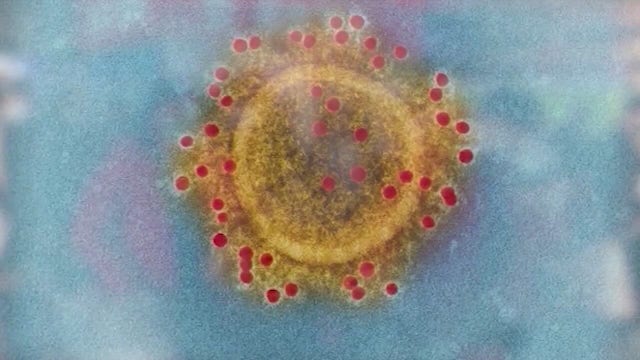 Deathtoll worldwide reaches 1 million mark from coronavirus