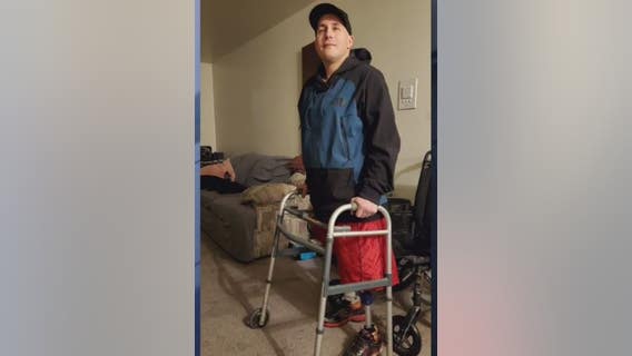Ann Arbor blind double amputee trying to raise money for new prosthetic legs