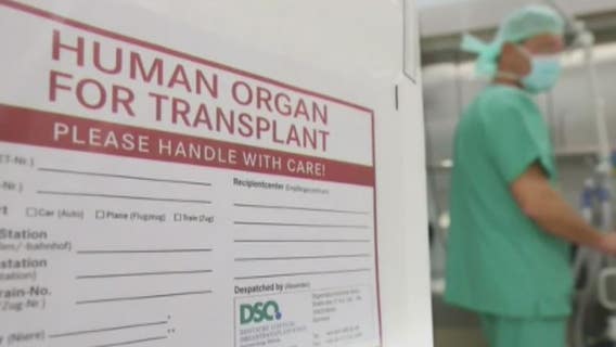 State Rep wants to make HIV organ donation to others with HIV legal in Michigan