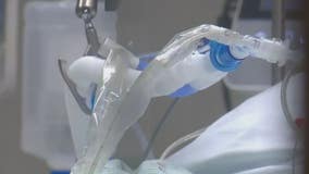 Visitation rules change as hospitals struggle to keep up with Covid surge