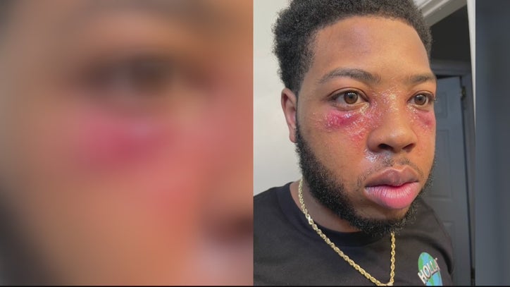 Michigan Rep. Jewell Jones' attorney says troopers used excessive force in drunk driving arrest - Vimarsana News