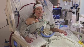 ECMO machine helps COVID-19 survivor hospitalized 3 months