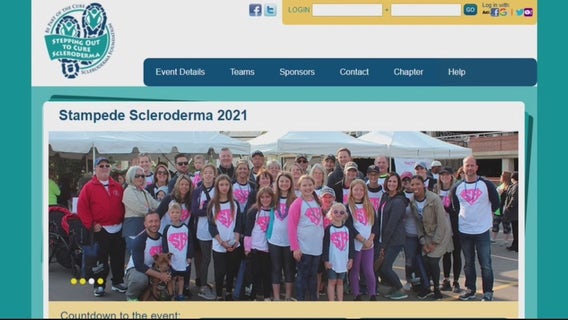 Man who went viral for "trick shots" uses new fame to raise money for Scleroderma