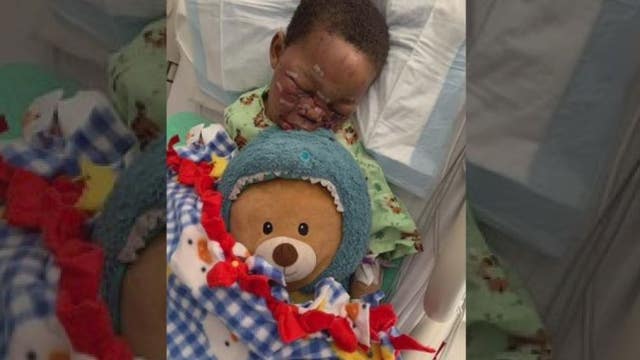 4-year-old mauled in dog attack in Detroit, suffering severe eye damage