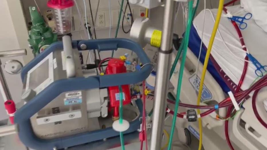 The ECMO removes all the blood from the body, oxygenates it, and pumps it back in - as the heart and lungs rest. 