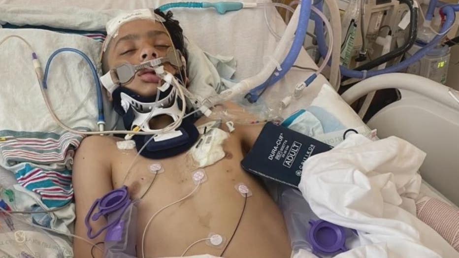 Luis Lopez was severely injured after being hit by a car on his minibike.