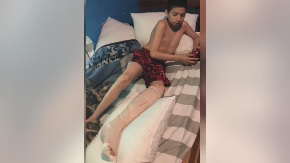 Ricardo Lopez, 13, suffered a broken leg in the minibike accident.