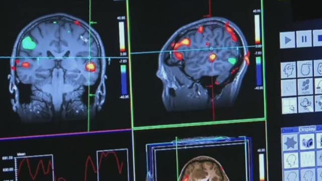 New FDA approved drug to treat Alzheimer's only helps in early stages, experts say