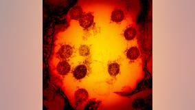 Cholesterol drug cuts coronavirus infection by 70%, researchers find