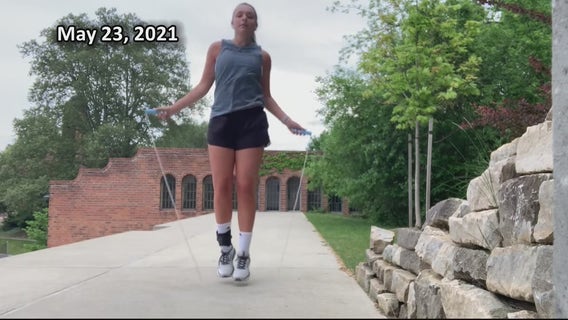 College senior suffers severe spinal injury, unlikely to walk - makes remarkable recovery