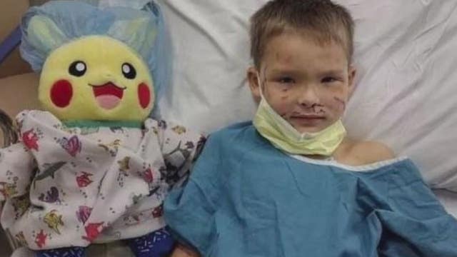9-year-old boy mauled by dogs slowly recovers as medical bills mount