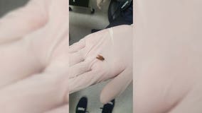 New Zealand man finds dead cockroach in ear after 3 days