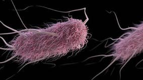 E. coli cases spike in 3 counties including in Oakland, alarming health officials