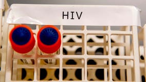 Woman appears to be cured of HIV after using new treatment, NIH says