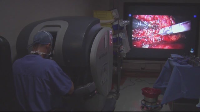 Catching cancer early -- When should you get a lung cancer screening?