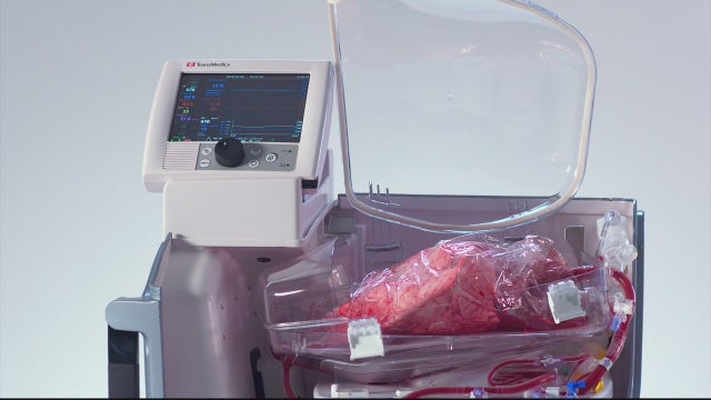 How technology is extending the life of donated lungs