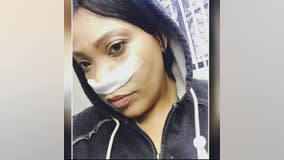 Sinus cancer survivor shares how she learned of the rare illness - and how she beat it