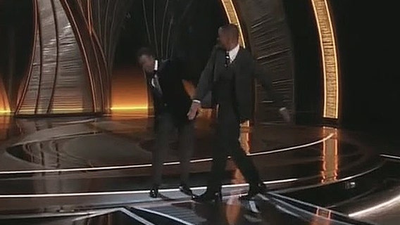 While Will Smith apologizes, doctor explains toll of alopecia