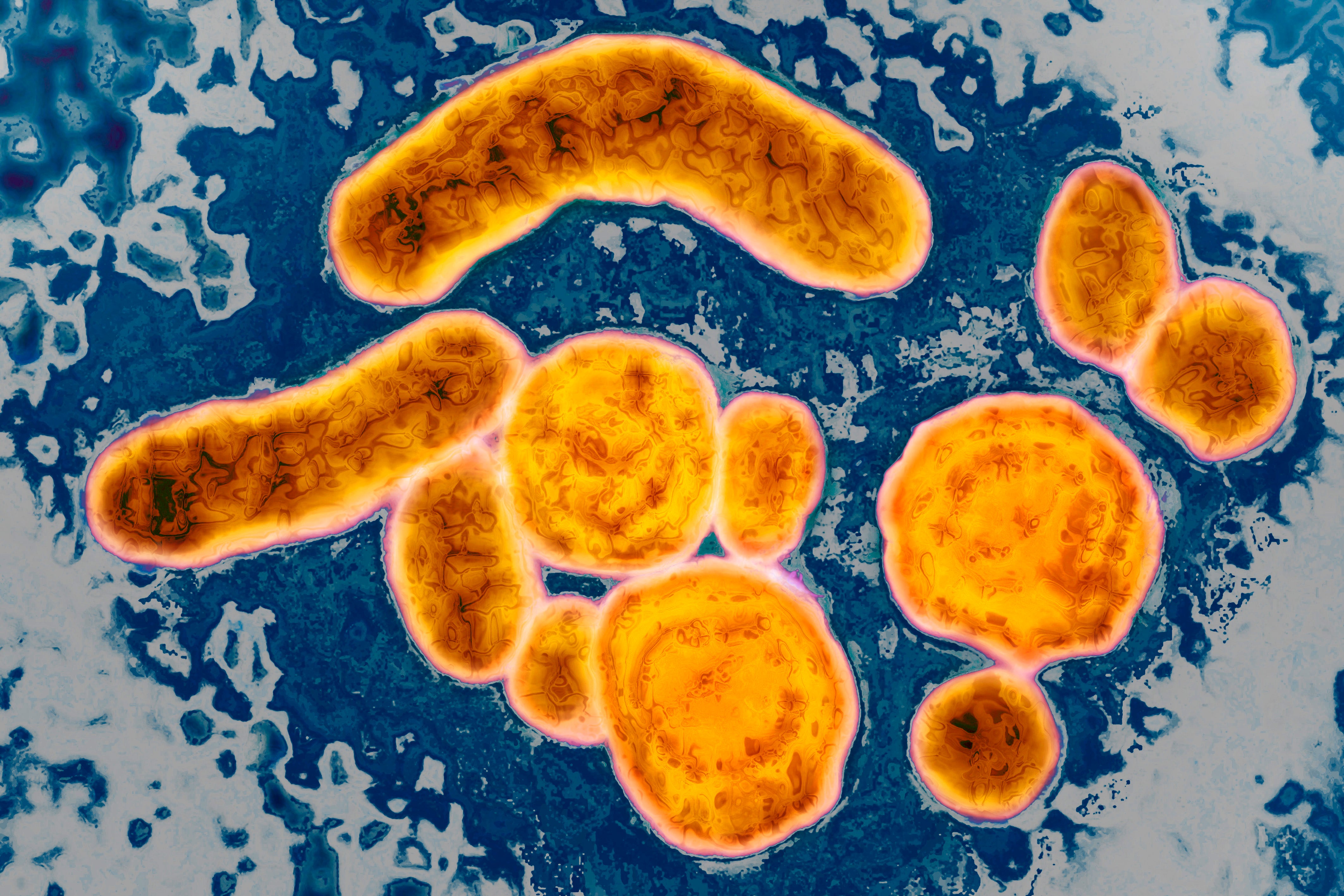 Michigan 'strongly opposes' new hepatitis B vaccine recommendation from CDC panel