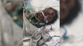 65-year-old man brutally beaten clings to life, while family is desperate for justice