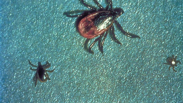 Ticks in Michigan: What you need to know about Lyme disease