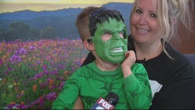 Transforming into the Hulk helps 4-year-old boy overcome fear of medical treatments