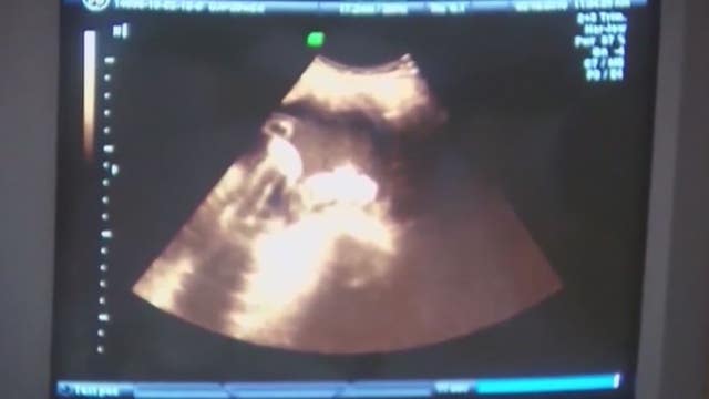 Oakland County judge upholds order to stop prosecution of 1931 abortion law