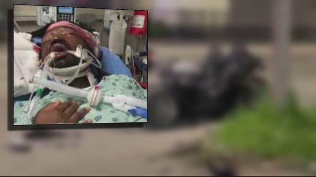 'He just wanted to go to the store': Detroit father of five is fighting for his life after a car accident