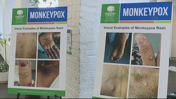 CDC: Monkeypox cases increase to 104 in Michigan