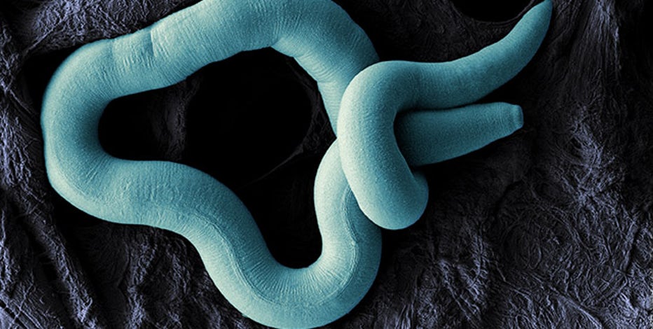 Invasive worm that causes Beech leaf disease spreading to Oakland and Wayne counties