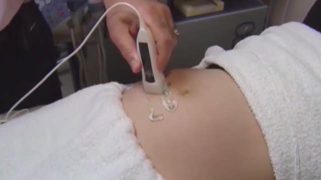 Pro-life, pro-choice arguments heard in Whitmer abortion lawsuit to halt 1931 state law